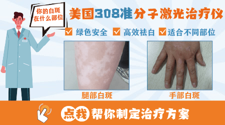 男性腰部白癜风的诱因是什么_1